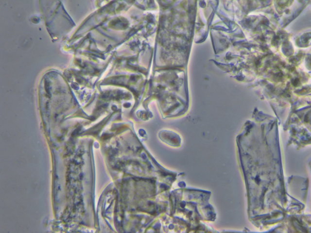 Botryobasidium con spore finemente verrucose